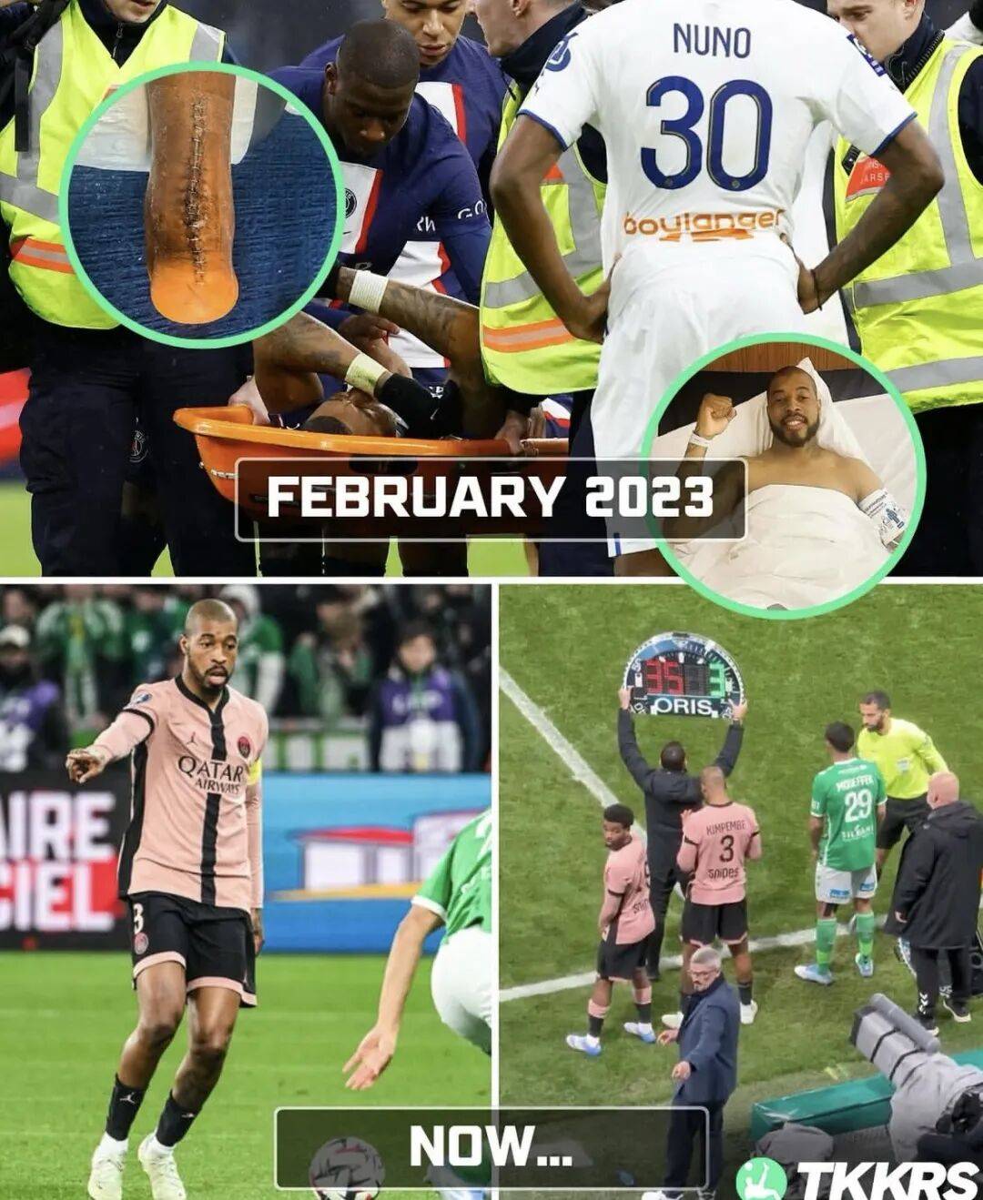 开云-赛地聚焦：法国杯今夜热度飙升，罗马造点机会，压力陡增，资深球员宣示担当-开云